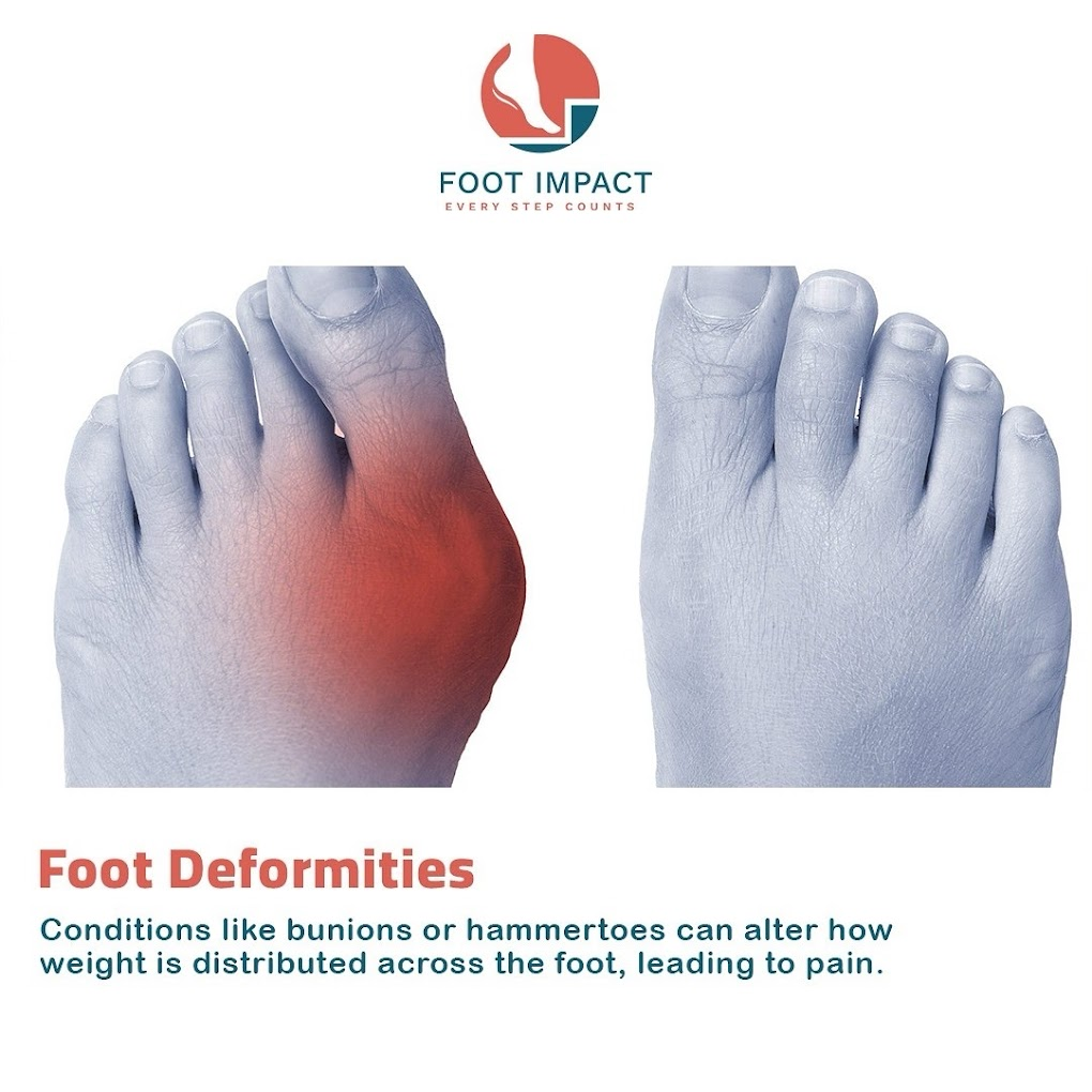 Ankle Pain Treatment In Andheri West